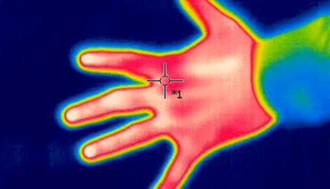 Thermal Camera at Tourist Attraction Spots Woman's Undiagnosed Breast Cancer